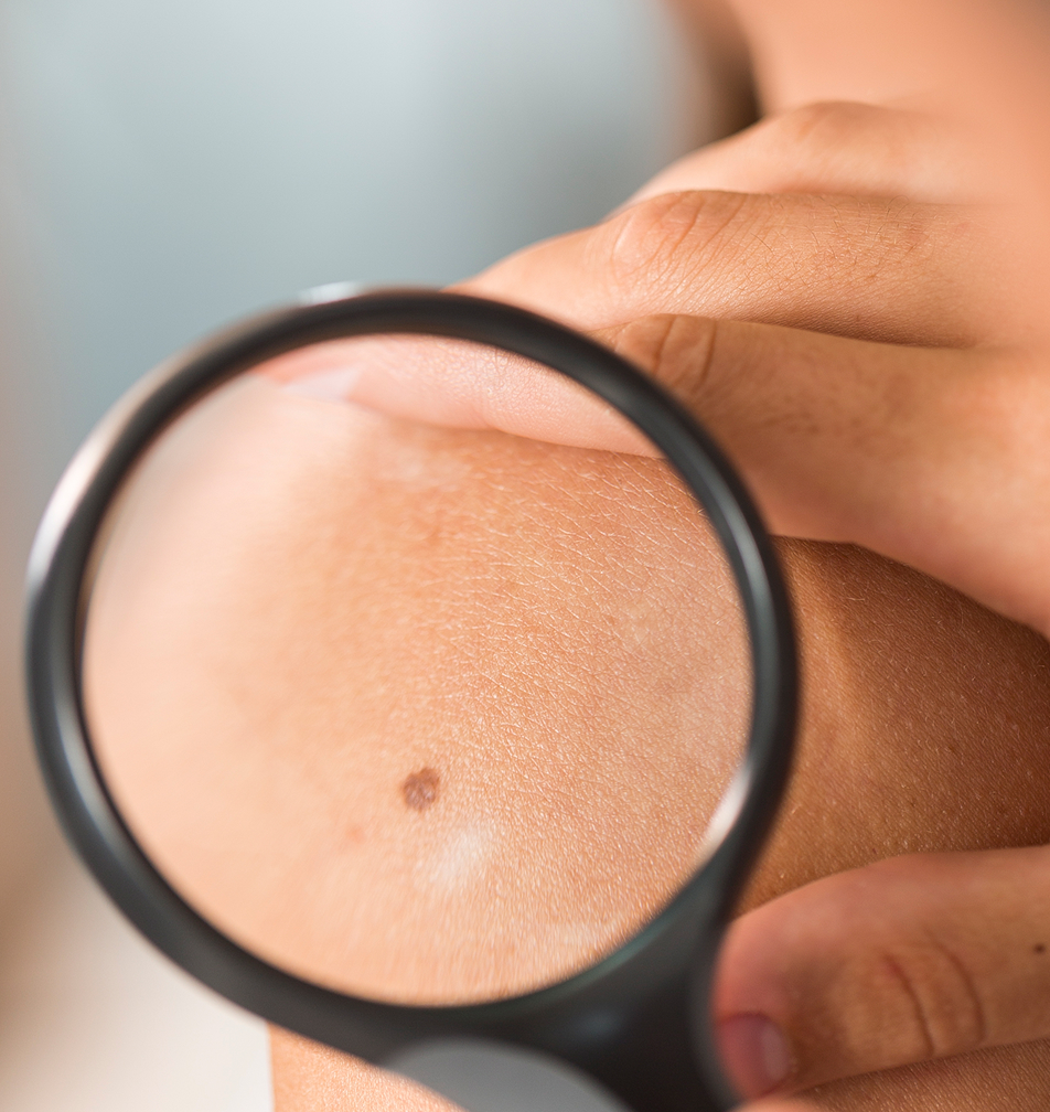 튀어나온 큰 점